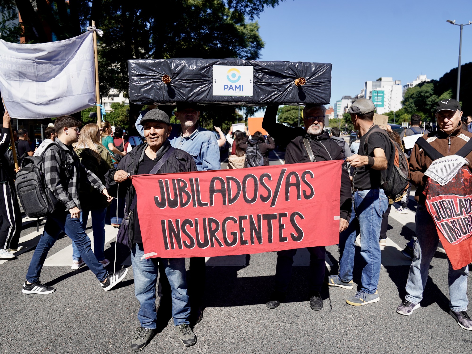 Una auditoría del PAMI detectó un esquema de sobreprecios en prestaciones oftalmológicas