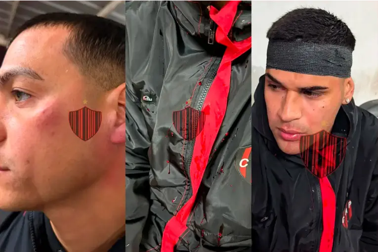 Investigan presunta agresión a jugadores de Patronato tras la derrota ante Colón