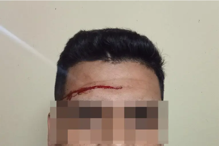 Atacó con un destornillador a un policía durante una notificación judicial en Gualeguaychú